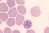 Babesia_microti_CDC