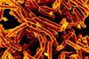 GD01 strain of Mycobacteroides abscessus isolated from patient