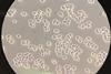 Saccharomyces_cerevisiae_100x_phase-contrast_microscopy2 (1)