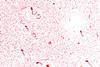 960px-Vibrio_cholerae_01