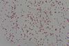 Gram_Negative_bacilli_of_Klebsiella_in_Gram_stained_smear_of_culture