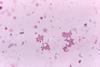 Veillonella_spp._under_1125X_magnification