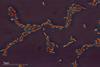 Escherichia_coli_(259_03)_Gramnegative_rods