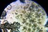 Microscope_view_of_Bacillus_subtilis_2