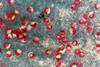 Cryptosporidium_Ziehl_Alae_Gati