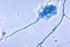 Aspergillus_fumigatus_01