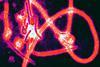 Ebola_virus_particles