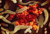 Novel_Coronavirus_SARS-CoV-2_(49531042907)