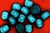 Mpox_Virus_Particles