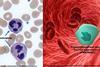 Low-Res_Michael May 22 Neutrophils and PMN-MDSC