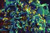 HIV-infected_H9_T_cell_(6813403685)