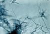 Streptomyces