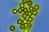 H1N1_Influenza_Virus_Particles_(8411599236)