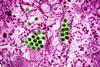 Dengue_Virus_Particles_(53231916461)