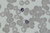 P._vivax_-_schizonts
