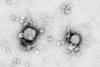 Lymphocytic_choriomeningitis_virus