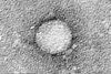 HCV_EM_picture_2