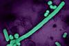 Influenza_A_Virus_(H3N2) (1)