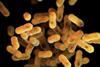 Whooping_Cough_United_States_Disease_Outbreaks