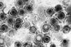 Herpes_simplex_virions,_TEM