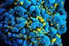 960px-HIV-infected_T_cell_(6813384933)