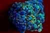 HIV-infected_H9_T_cell