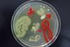 Human Microbiome Agar Art with Living Microbes