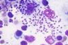 703px-Leishmania_infantum (1)