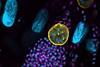 Low-Res_toxoplasma-gondii-parasite-microscope