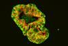 Low-Res_241011_Morbus Crohn_Lehrstuhl für Immunologie (1)