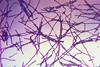960px-Bacillus_anthracis_Gram
