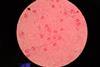Encapsulated_strain_of_Streptococcus_pneumoniae_in_clinical_sample_sputum_Gram_staining