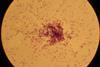 Lactococcus_lactis