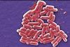 Escherichia_coli_electron_microscopy