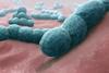 Streptococcus_pneumoniae_-_A_causative_bacteria_of_meningitis