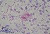 Pseudomonas_aeruginosa_smear_Gram_2010-02-10