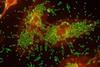 Low-Res_Two distinct patterns of attachment to human cells