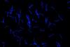Low-Res_Borrelia_recurrentis_c_Flavia_Reyer_unimedizin-ffm