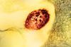 Measles_Virus_Particle