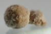 800px-Kidney_stone_4mm_05