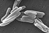 Mycobacterium_tuberculosis (1)