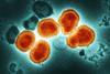 Influenza_A_Virus_(H3N2)_(52747876754)