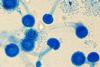 Antonio_e_Biagio_e_Cesare_Arrigo_Aspergillus_fumigatus_01