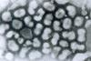 Influenza_A_-_late_passage (1)