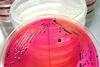 XLD_agar