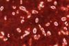 Капсула_Klebsiella_Pneumoniae