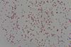 Gram_Negative_bacilli_of_Klebsiella_in_Gram_stained_smear_of_culture (1)