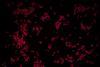 Fluorescent image of Mycobacterium tuberculosis