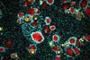 Low-Res_Macrophages with Vibrio cholerae_1000x1000