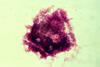 ClueCell_de_vaginose_à_Gardnerella